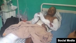 Juan Alberto De la Nuez Ramírez fue brutalmente golpeado por una banda de delincuentes, denunció el Consejo para la Transición Democrática en Cuba. (Facebook/José Daniel Ferrer)