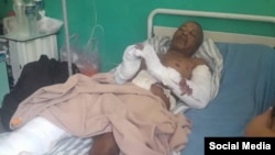 Juan Alberto De la Nuez Ramírez fue brutalmente golpeado por una banda de delincuentes, denunció el Consejo para la Transición Democrática en Cuba. (Facebook/José Daniel Ferrer)